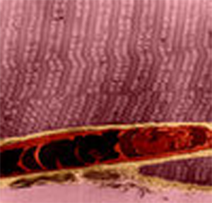image via transmission electron microscope of a capillary between muscle fiber